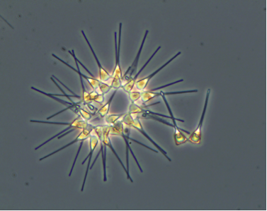 Photo of Asterionellopsis glacialis by Dr. Vera Trainer and Brian Bill, NOAA