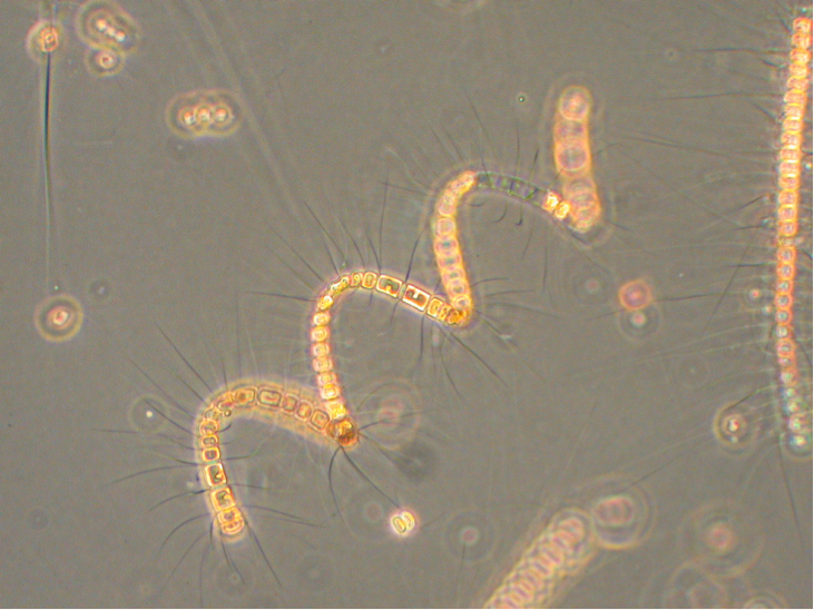 Photo of Chaetoceros debilis by Dr. Vera Trainer and Brian Bill, NOAA