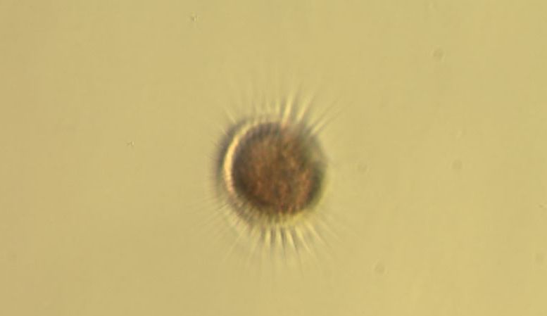 Image of Mesodinium rubrum by Teri King, WSG