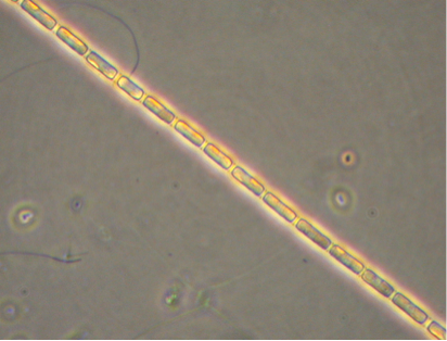Light microscopy image of Skeletonema by Brian Bill, NOAA