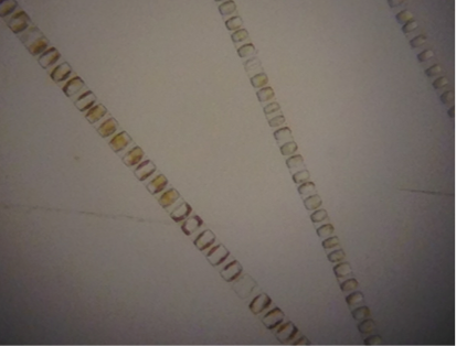 Light microscopy image of Skeletonema by J. Runyan, Washington Sea Grant